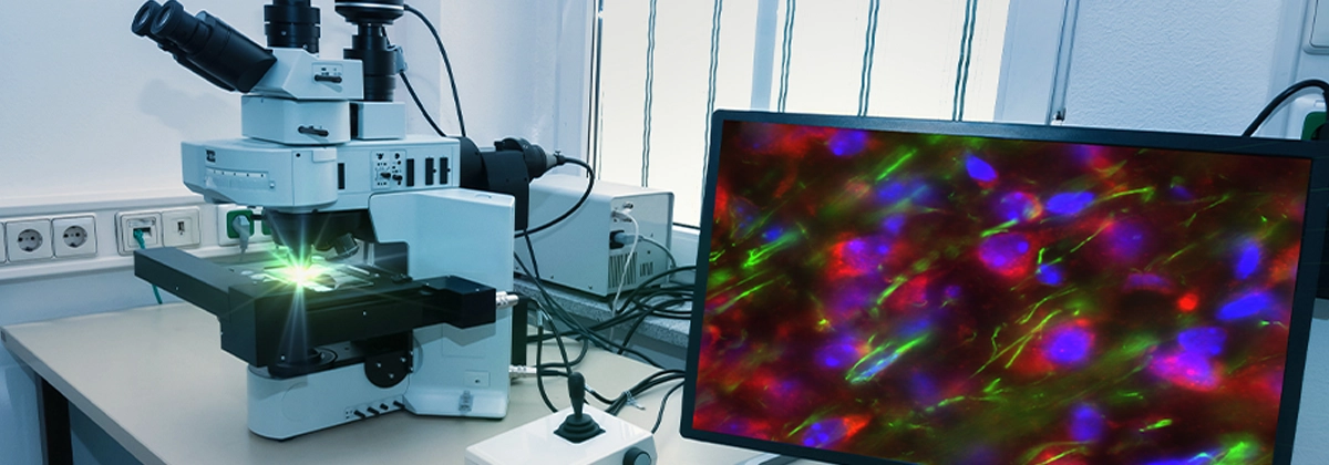 Optical Solutions for Fluorescence Imaging